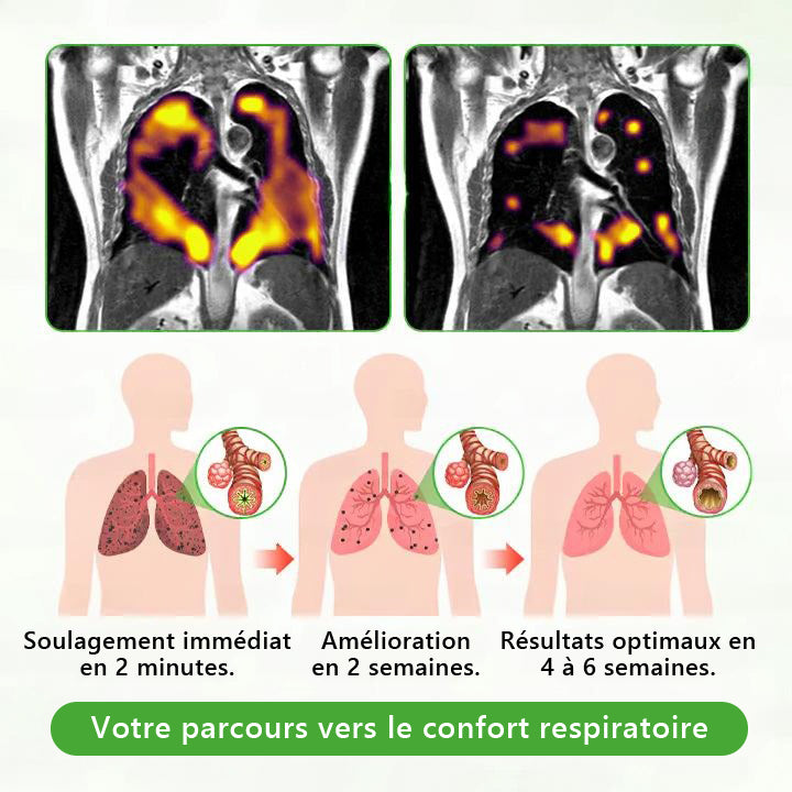 Diffuseur 𝑴𝒖𝑟𝑤𝗈𝗇® à base de plantes Mullein pour le nettoyage des poumons (🫁 Toux, pharyngite, essoufflement, expectorations, nez bouché, bronchite, symptômes allergiques, inconfort pulmonaire)💖
